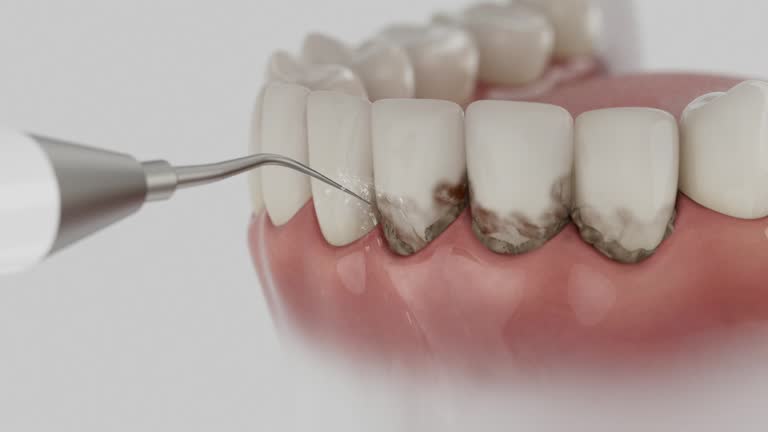 Trusted Tooth Extraction service in Van Buren, AR - Dentist Open Now